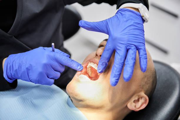 Best Dentist for Tooth Abscess  in Sidney, IL
