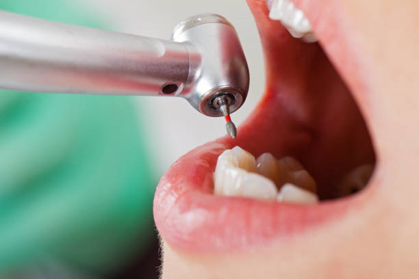 Best Tooth Infection Emergency Dentist  in Sidney, IL